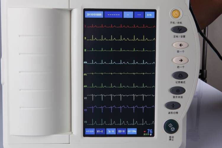Machine ECG humain examen cardiaque cardiologie ECG 12 canaux machine ECG EKG électrocardiogramme ECG