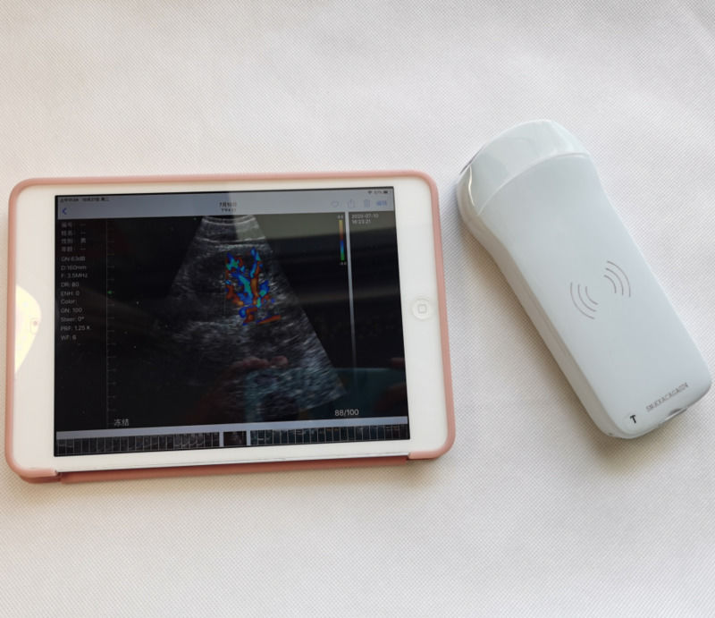 Usg New Look 3d Image GYN Image Laptop Ob Gyn Fœtal machine à ultrasons Doppler de couleur avec haute qualité