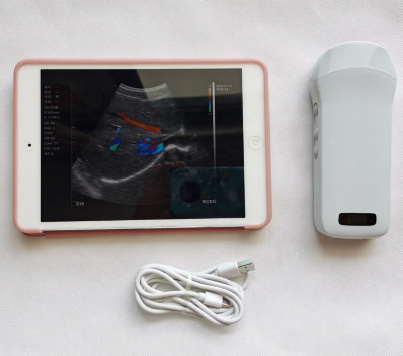 Usg New Look 3d Image GYN Image Laptop Ob Gyn Fœtal machine à ultrasons Doppler de couleur avec haute qualité