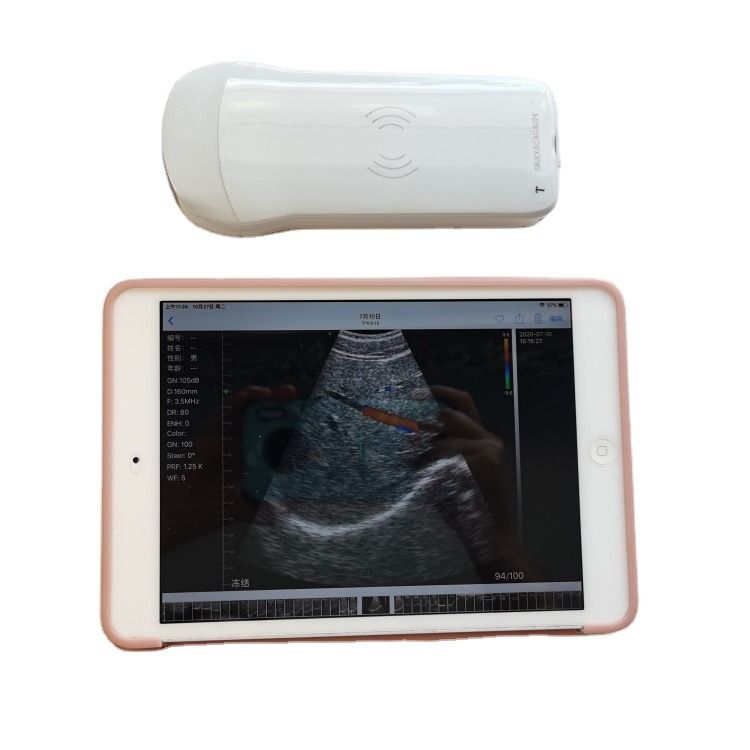 GYN Appareil d'échographie médicale vétérinaire portable de haute qualité à livraison rapide pour le diagnostic 3D des chevaux et des vaches
