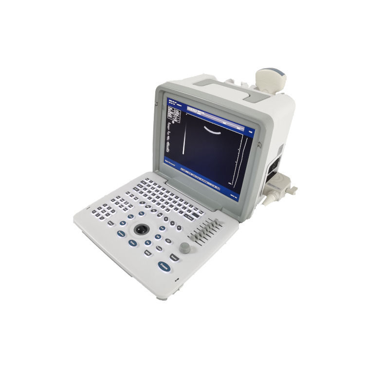 Machine d'échographie fœtale portable Doppler de grossesse B W pour bébé, scanner radio, ordinateur portable en métal