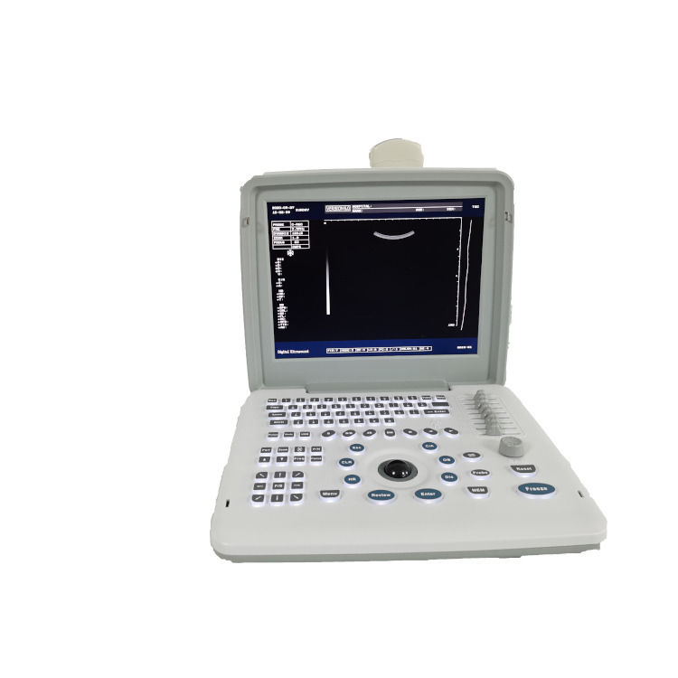 Machine d'échographie fœtale portable Doppler de grossesse B W pour bébé, scanner radio, ordinateur portable en métal