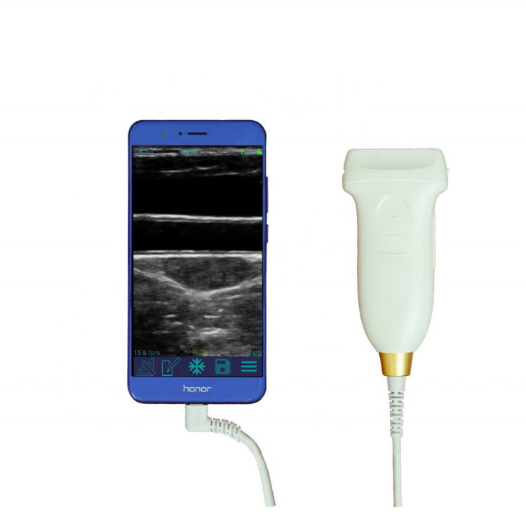 Sonde d'échographie gynécologique 3 en 1 usb wifi sondes d'échographie convexes sans fil pour Android
