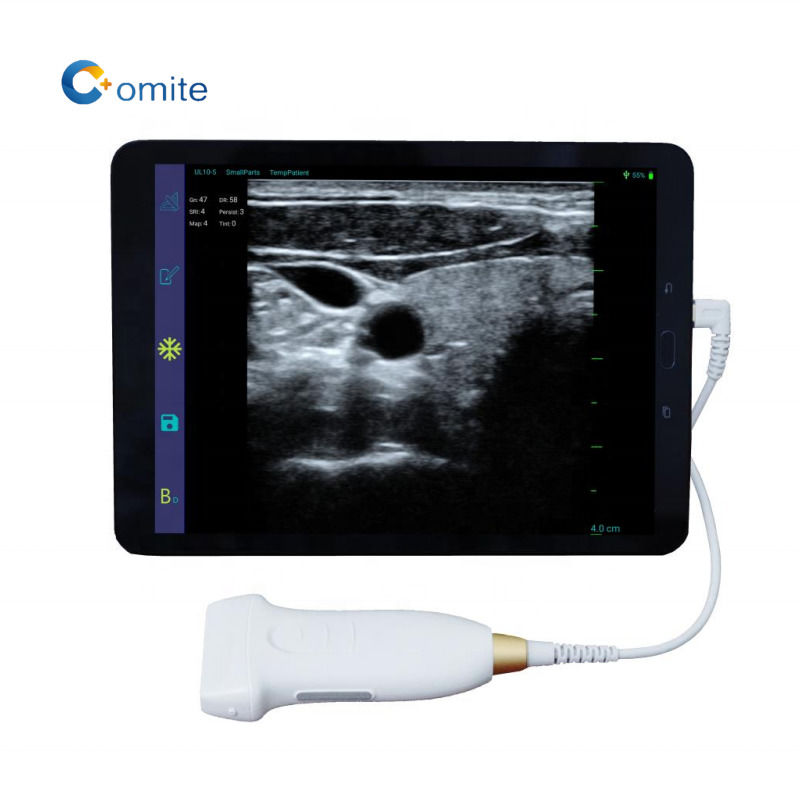 Sonde d'échographie gynécologique 3 en 1 usb wifi sondes d'échographie convexes sans fil pour Android