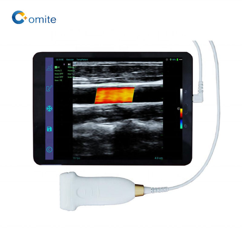 Sonde d'échographie gynécologique 3 en 1 usb wifi sondes d'échographie convexes sans fil pour Android