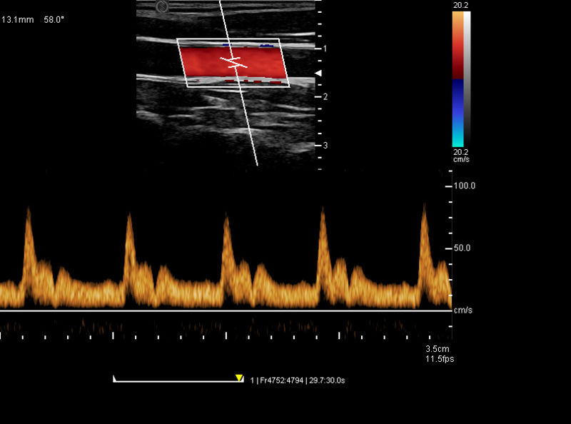 Chine Chariot Numérique Couleur Doppler Échographie Appareil Médical Échographique Hôpital Extérieur