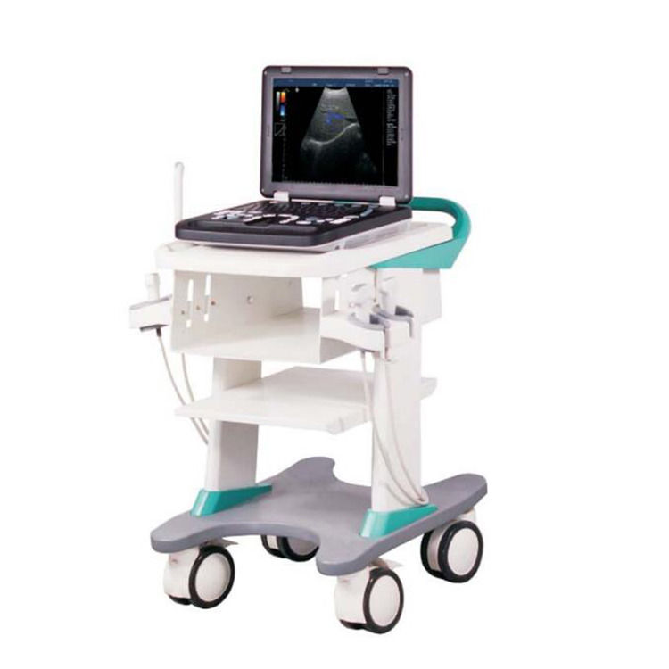 100% de garantie Portable couleur Doppler échographie échocardiographie Echo machine à ultrasons
