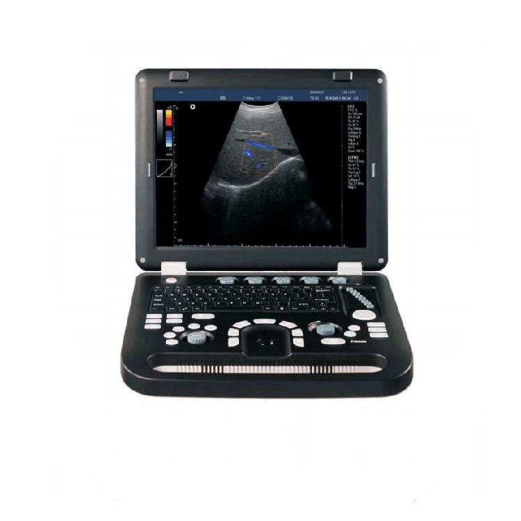 100% de garantie Portable couleur Doppler échographie échocardiographie Echo machine à ultrasons