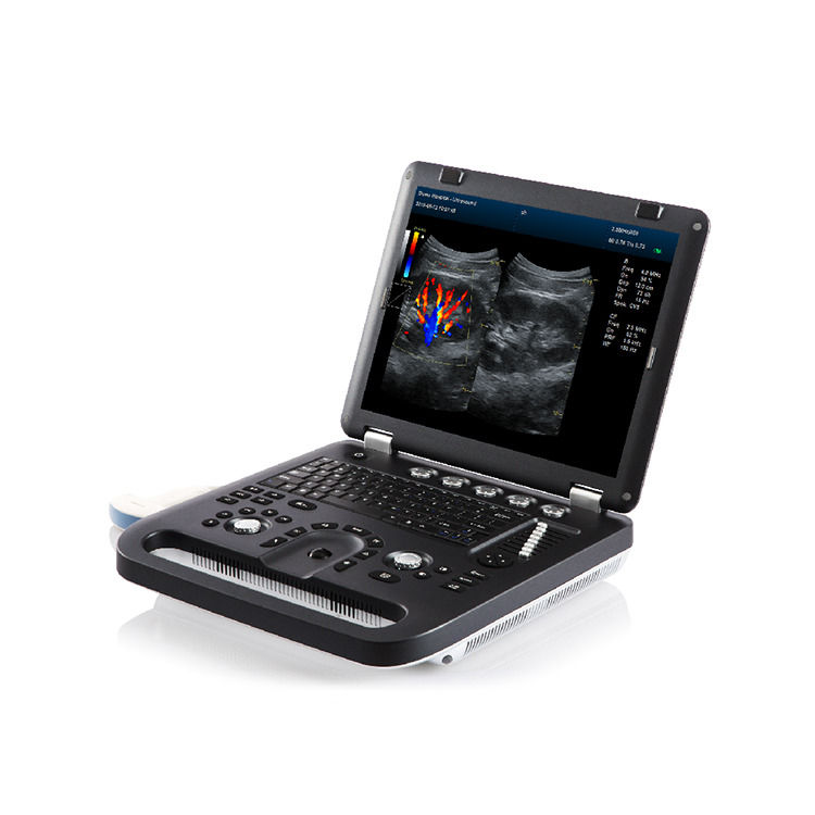 100% de garantie Portable couleur Doppler échographie échocardiographie Echo machine à ultrasons