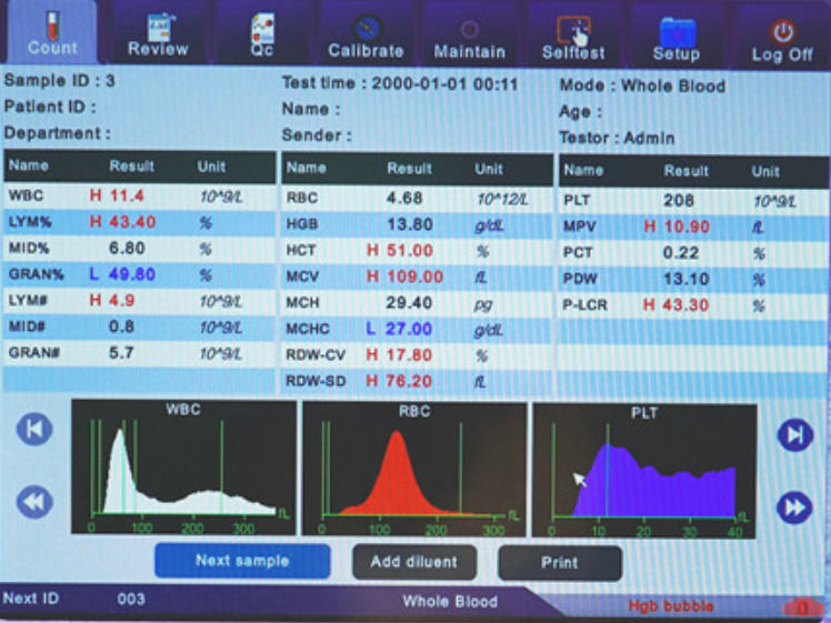 Instruments d'hématologie entièrement automatiques d'analyse clinique, analyseur de cellules sanguines Comite Plus, analyseur d'hématologie entièrement automatique CMT-800