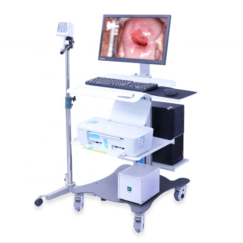 Colposcope gynécologique portable Système d'imagerie colposcopique numérique Examen vaginal Vidéo colposcope pour gynécologie