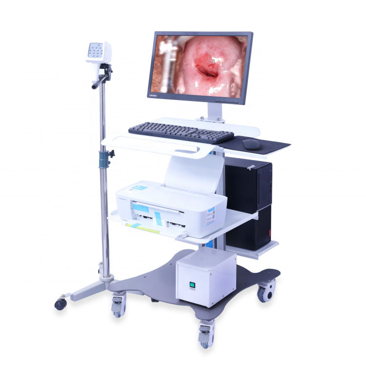 Colposcope gynécologique portable Système d'imagerie colposcopique numérique Examen vaginal Vidéo colposcope pour gynécologie