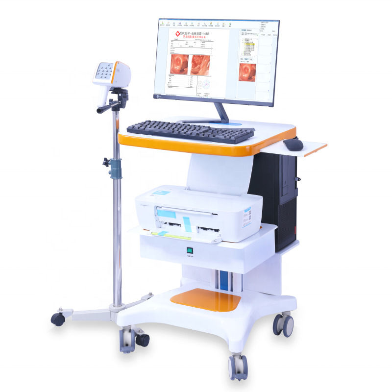 Colposcope gynécologique portable Système d'imagerie colposcopique numérique Examen vaginal Vidéo colposcope pour gynécologie